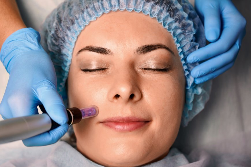 Microneedling